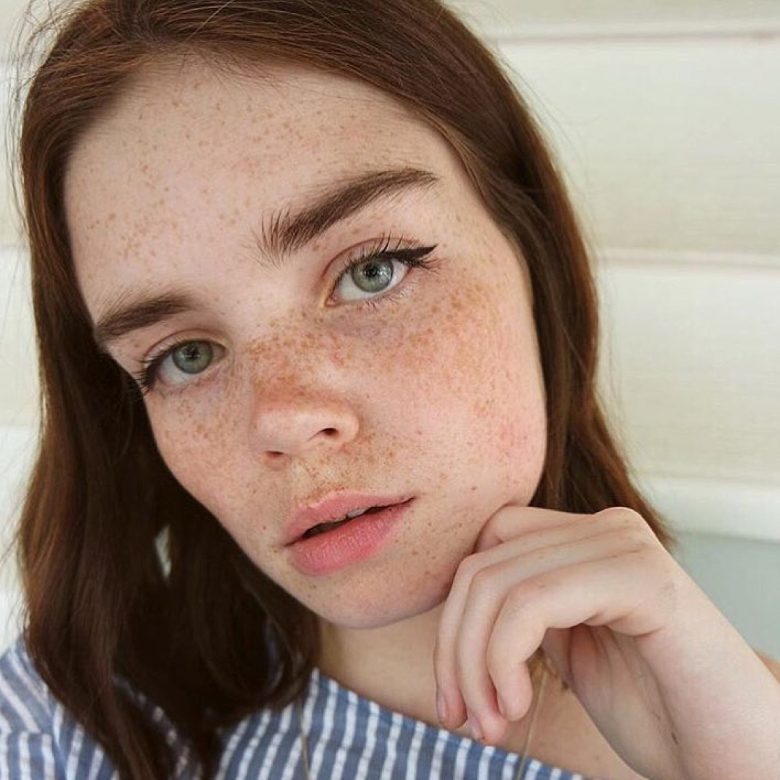 A young woman with freckles gazes back at the viewer